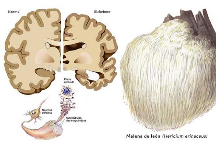 Te Latte CaféElixir de Hericium erinaceus (MELENA DE LEÓN)
